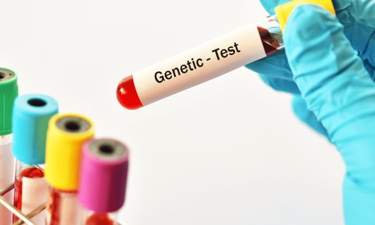 Genetic Testing